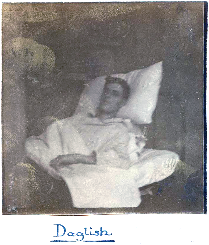 Daglish wounded in hospital bed